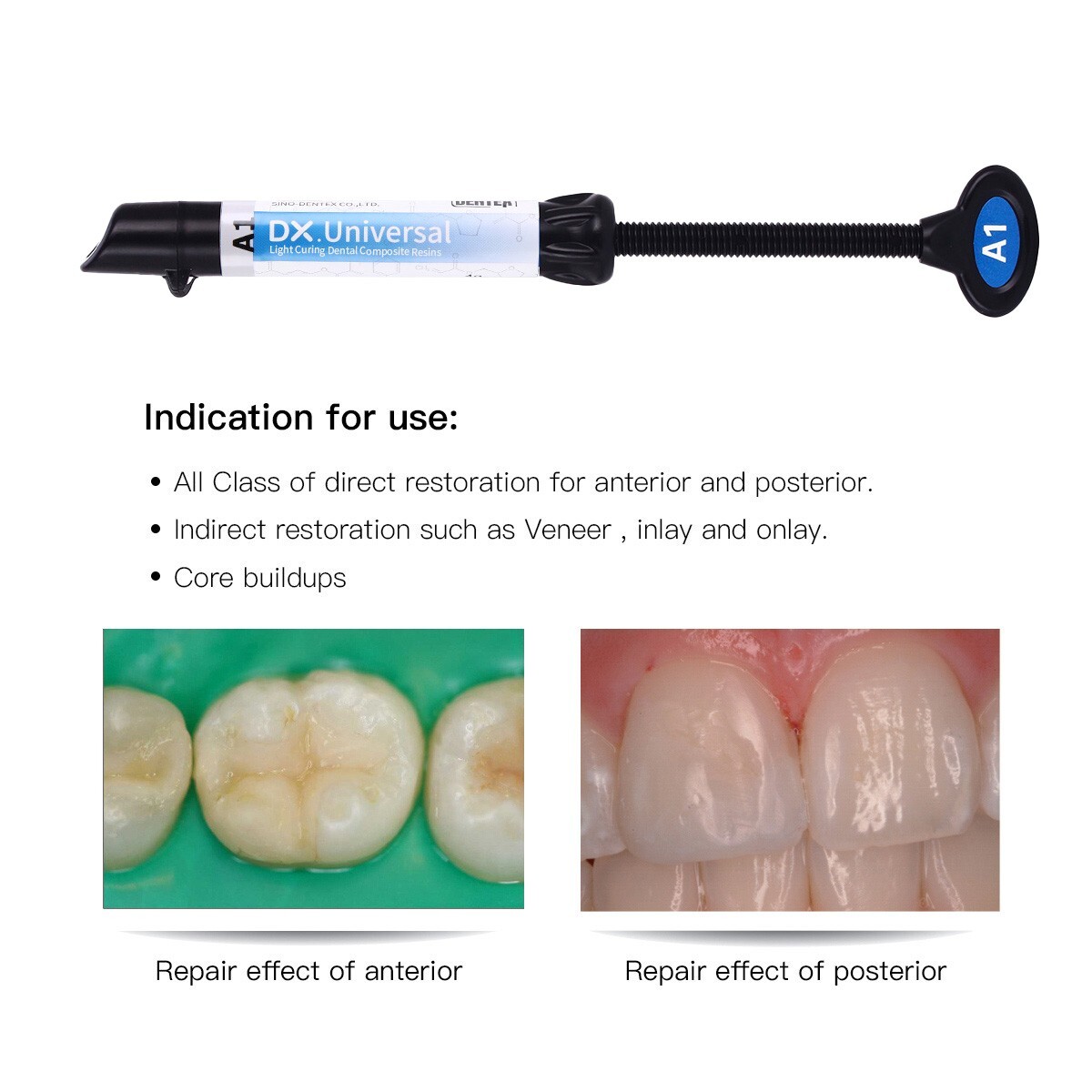 Dental Universal Light Cure Hybrid Composite Resin A1, A2, A3, A3.5,B1