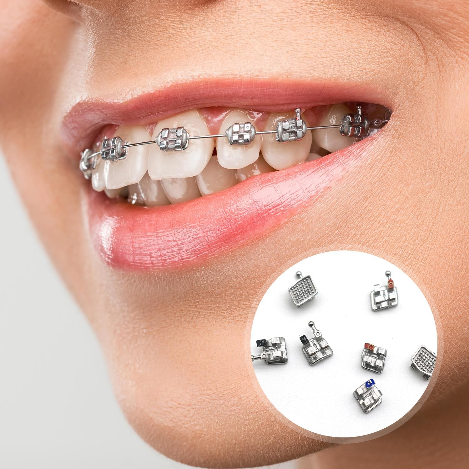 Mini Roth Brackets 300pcs/Pack with Hook on 345 Teeth