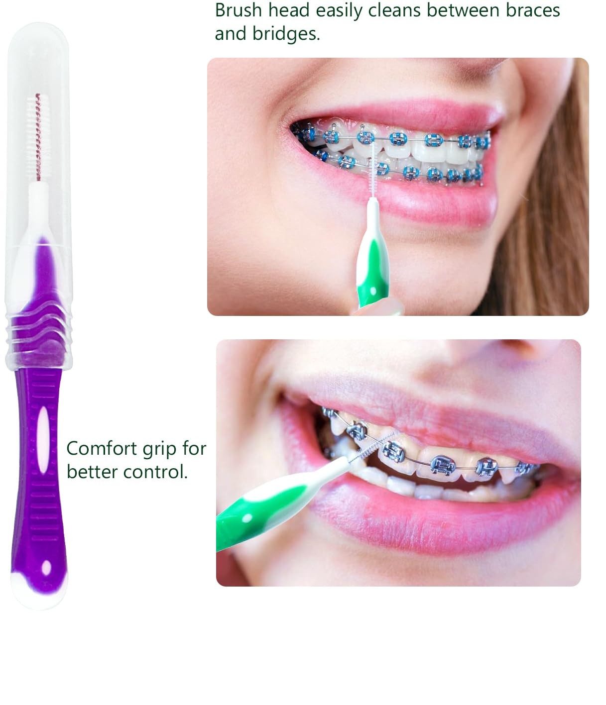 Uouovo Portable Orthodontic Oral Care Kit 1 Count (Pack of 2), Purple_blue