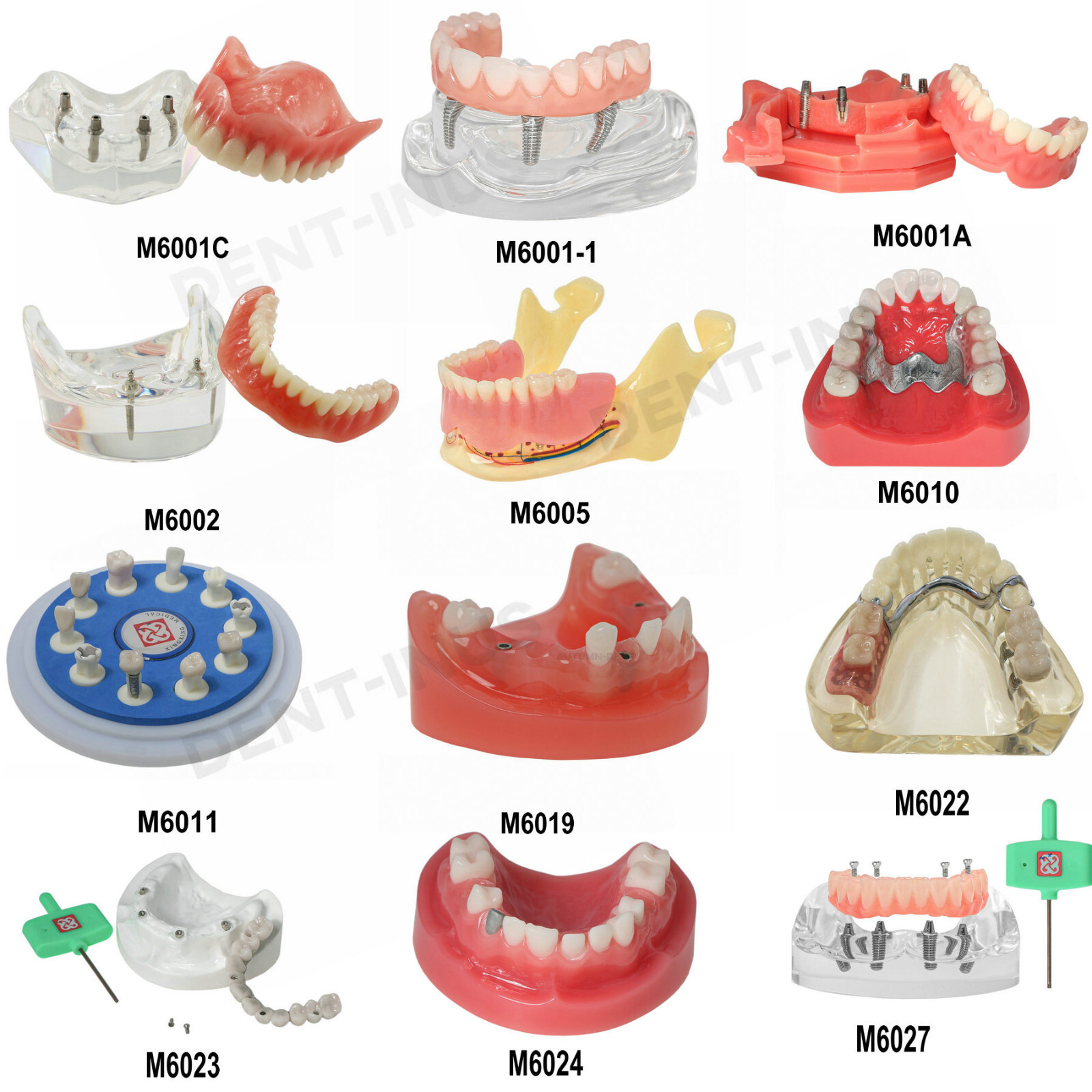 Implant Typodont Teeth Restoration Model Overdenture Practice Demo Series Dental