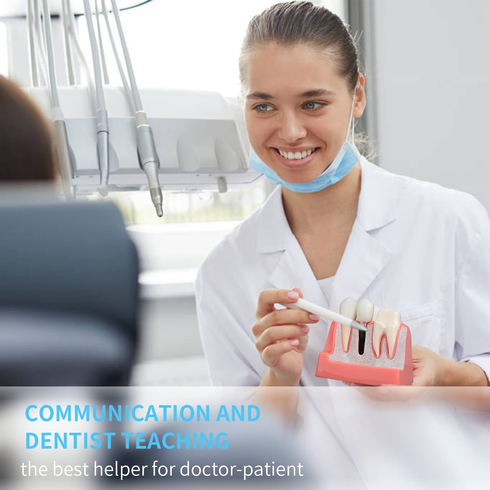 ANNWAN Dental Implant Model 4 Times Removable Analysis 4
