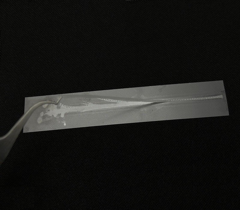 Dental Material Flexible Fiber Strip Glass Splint Loose Tooth Fixation Strips US
