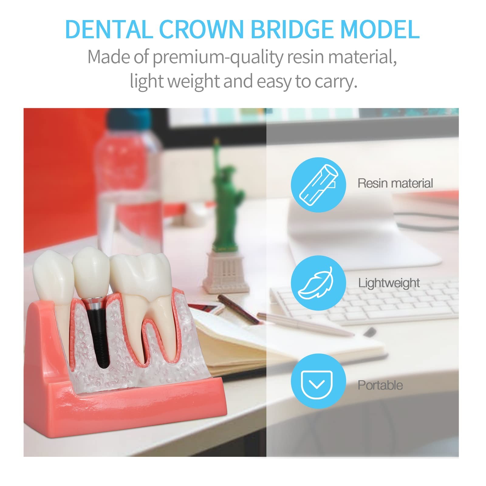 ANNWAN Dental Implant Model 4 Times Removable Analysis 4