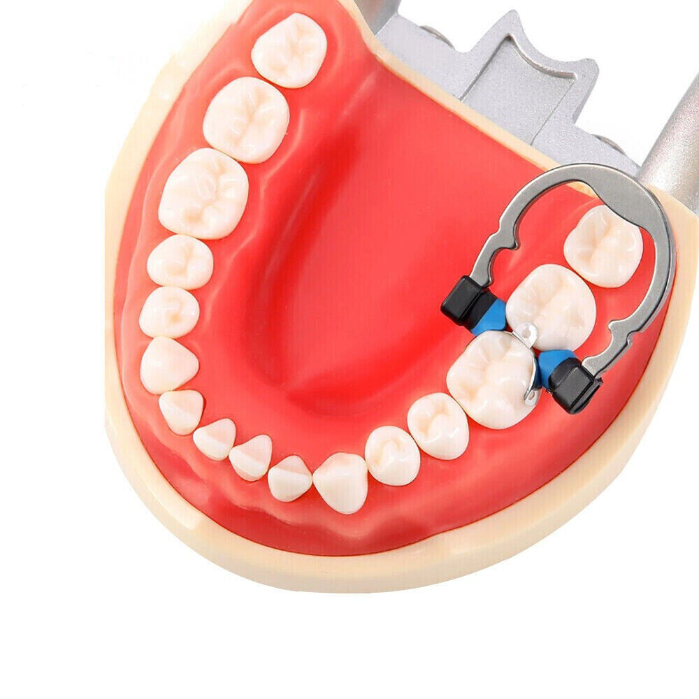 Dental Matrix Bands Clamp Niti Titanium Ring Alloy Sectional Matrice Crown 6.3mm