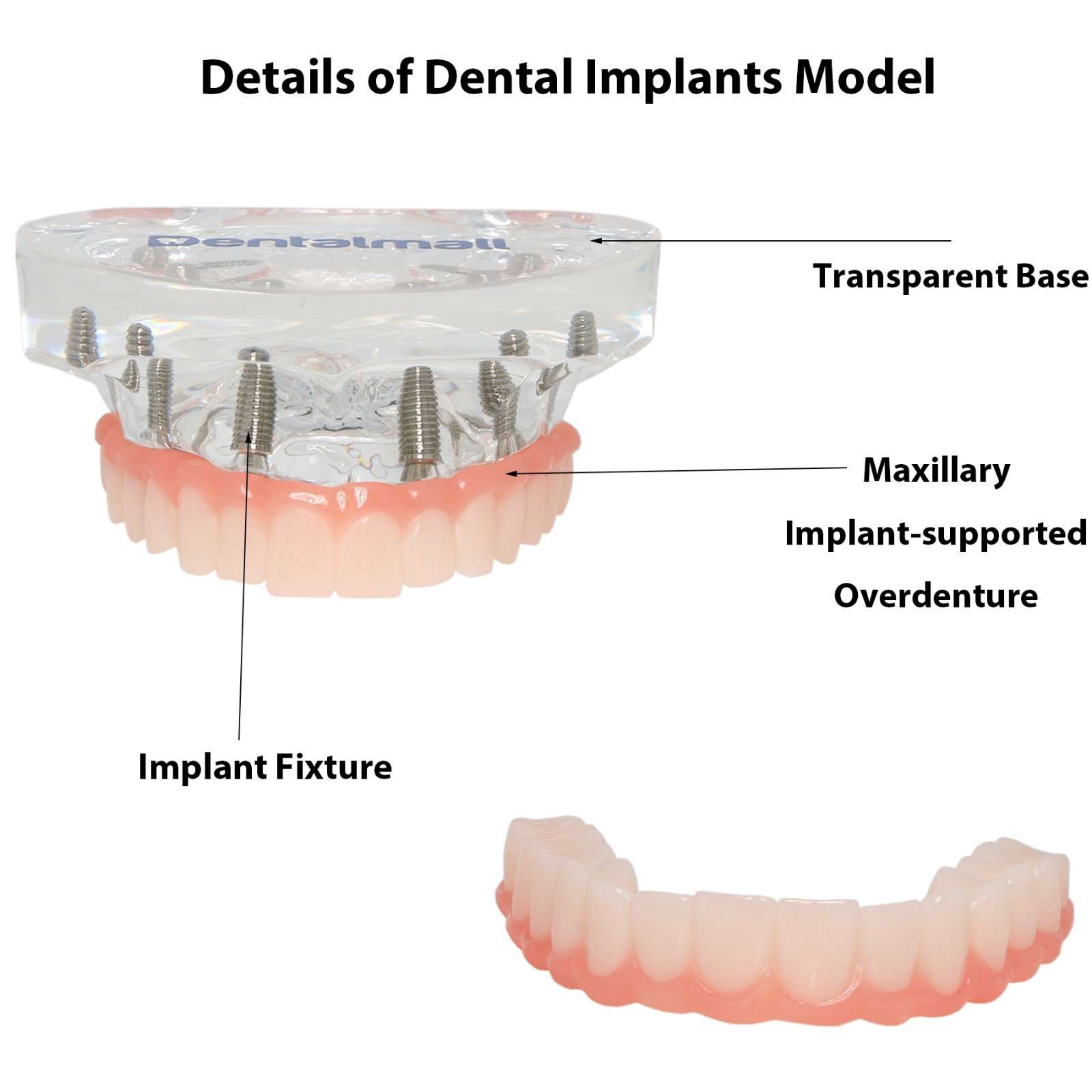 Dental Implant Overdenture Model Upper Lower Jaw Teeth Model with 2/4/6 Screws
