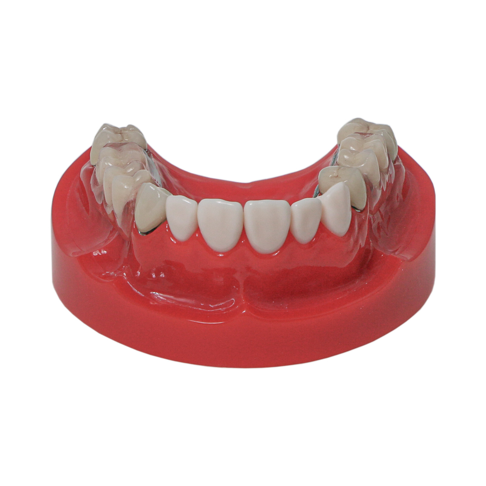 Implant Typodont Teeth Restoration Model Overdenture Practice Demo Series Dental