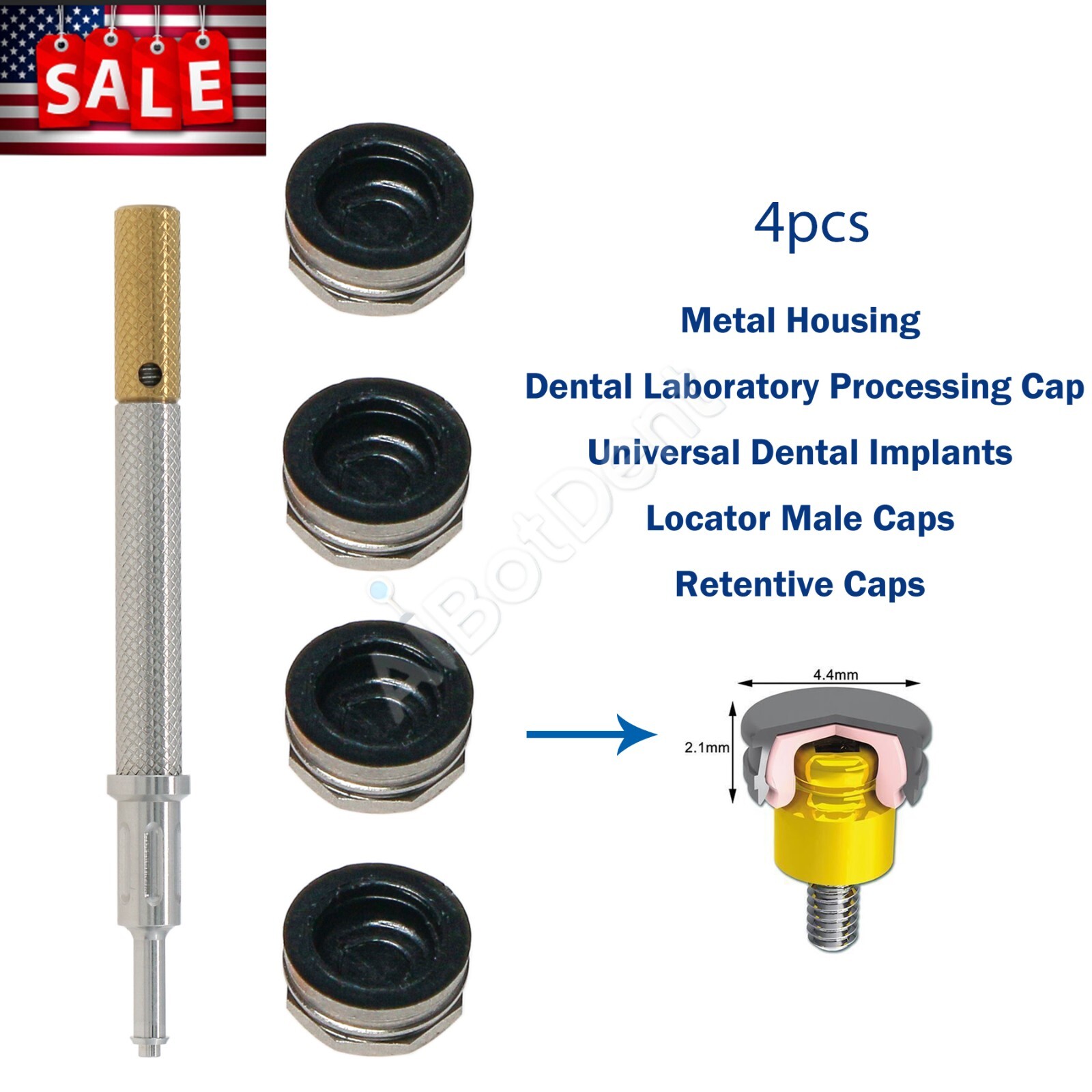 US Dental Nobel NP-NA353 Implant Attachment Abutment Male Caps Kit 3.0mm PEEK