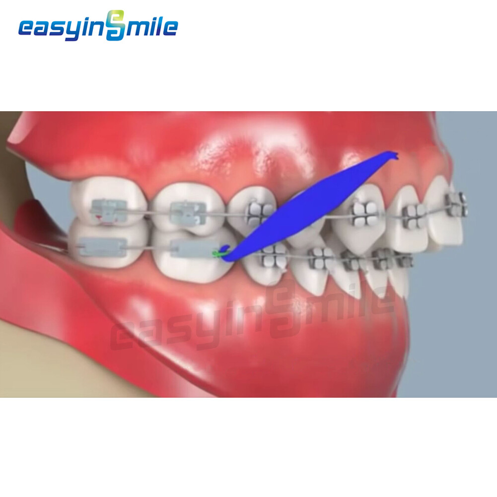 100Pcs Dental Orthodontic Elastic Bands Placer for Braces Rubber Easyinsmile