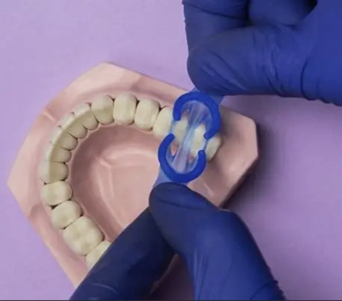 MiniDam Gingival Guard Silicone Rubber Dam Clamp Holder Clip 2/3holes 20pcs/box