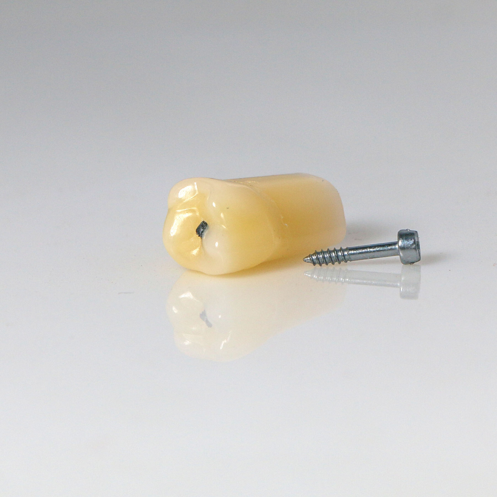 Dental Typodont Teeth Model with Caries Spots 28 Pieces Fits Kilgore Nissin 200