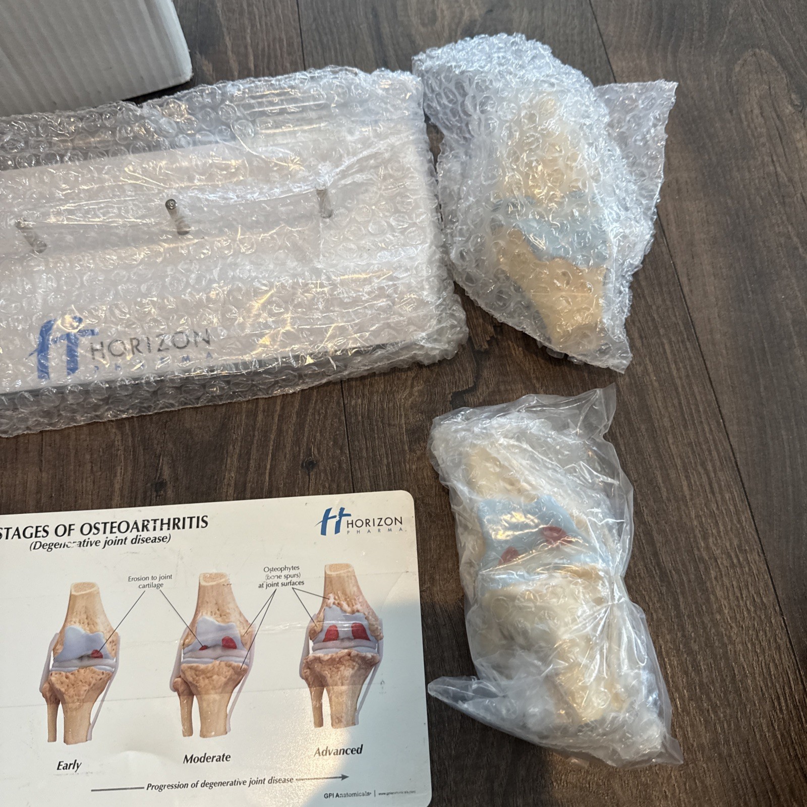 Knee Joint Osteoarthritis GPI Model Set horizon pharma