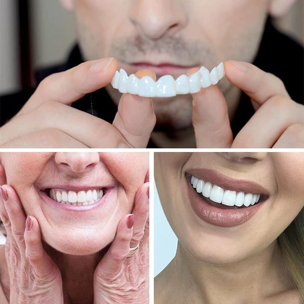 Top and Bottom Fake Teeth Cover the Broken Missing 1 Count (Pack of 1)