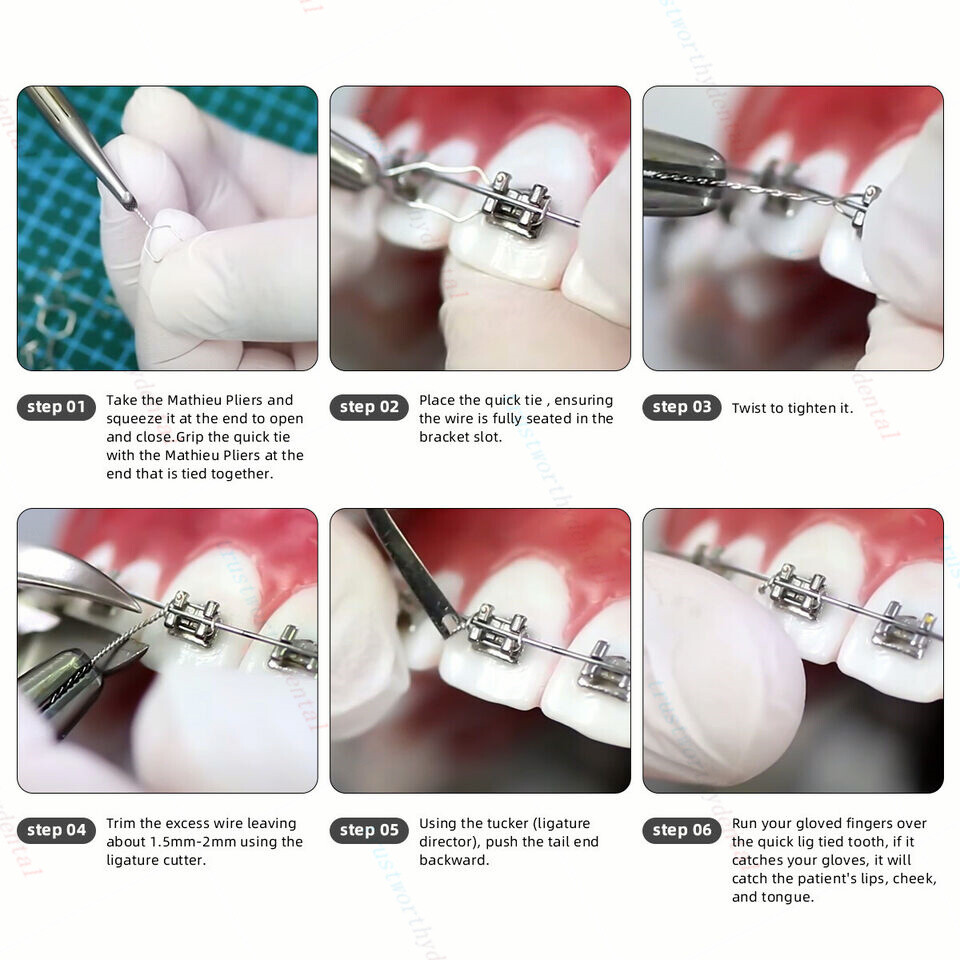 Orthodontic Dental Preformed Ligature Wire Kobayashi Ligatures Ties Brackets