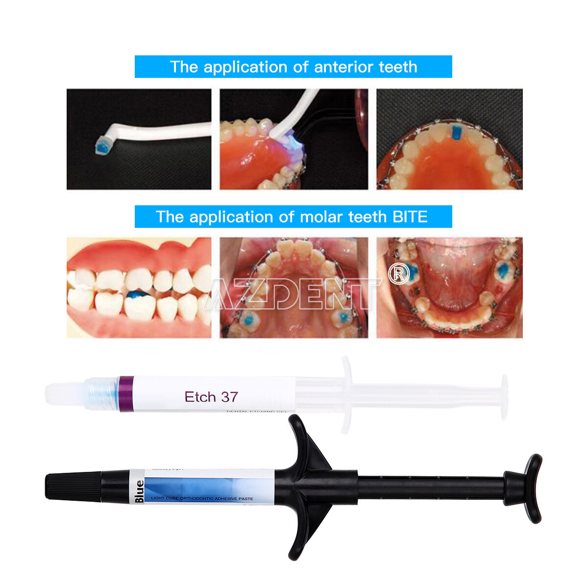 Dental Light Cure Orthodontic Brackets Adhesive Paste Acid Etching Gel Blue Kit