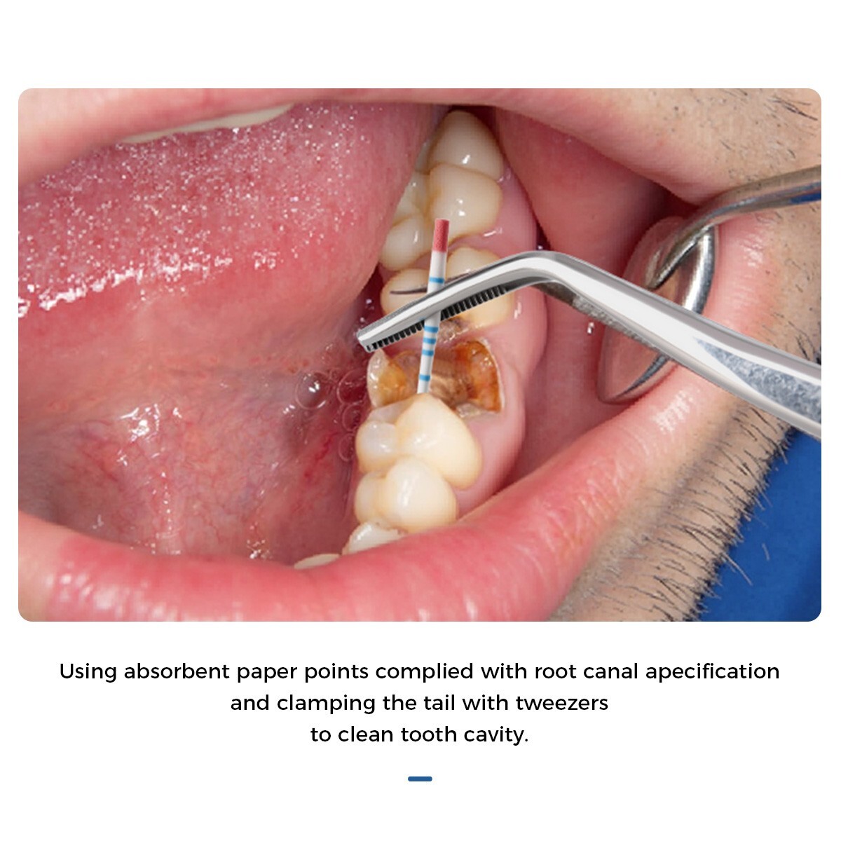 AZDENT Dental Gutta Percha Points Absorbent Paper Points Taper Endodontic Root