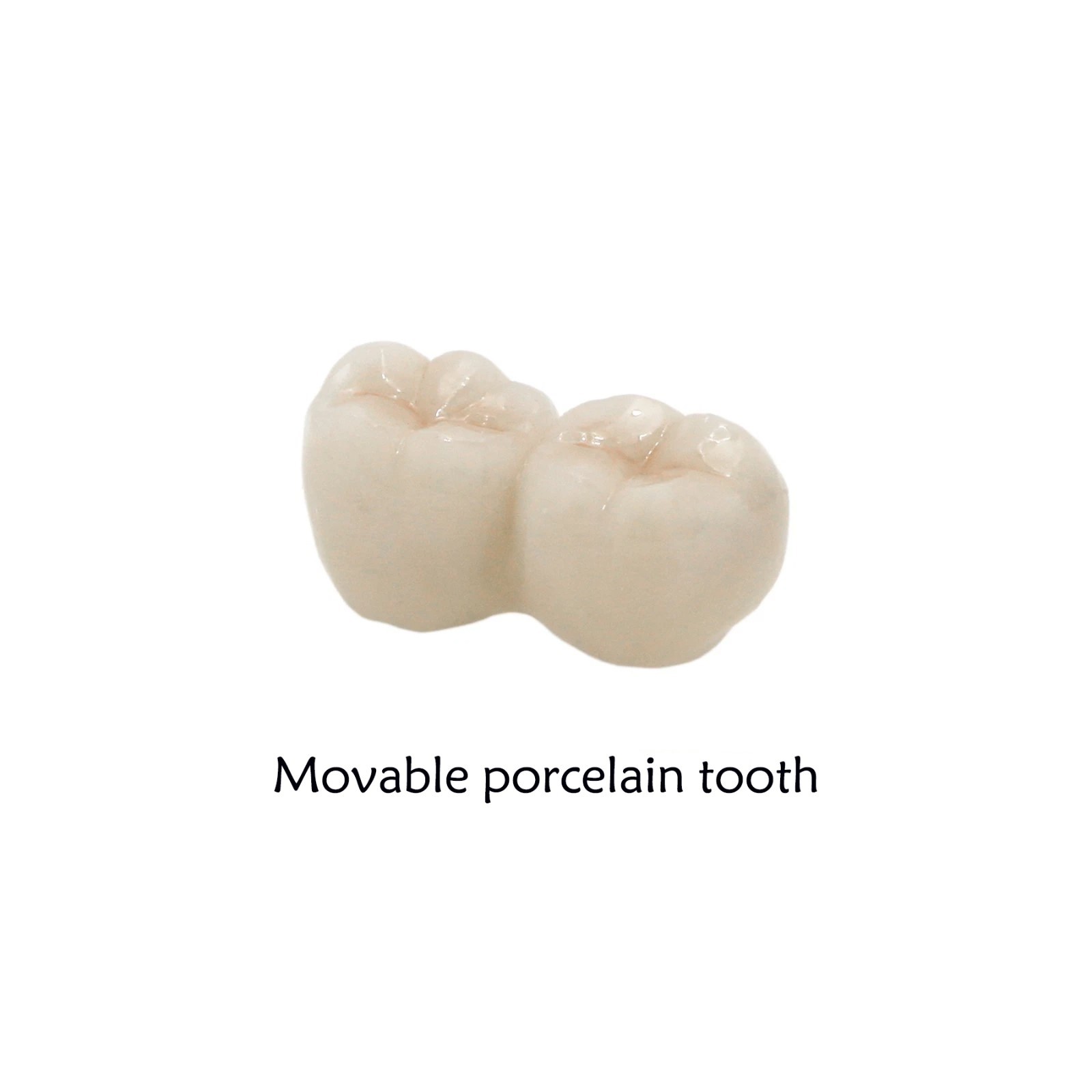 Typodont Restoration Dental Teeth Model With Partial Denture Demo 2 Implants