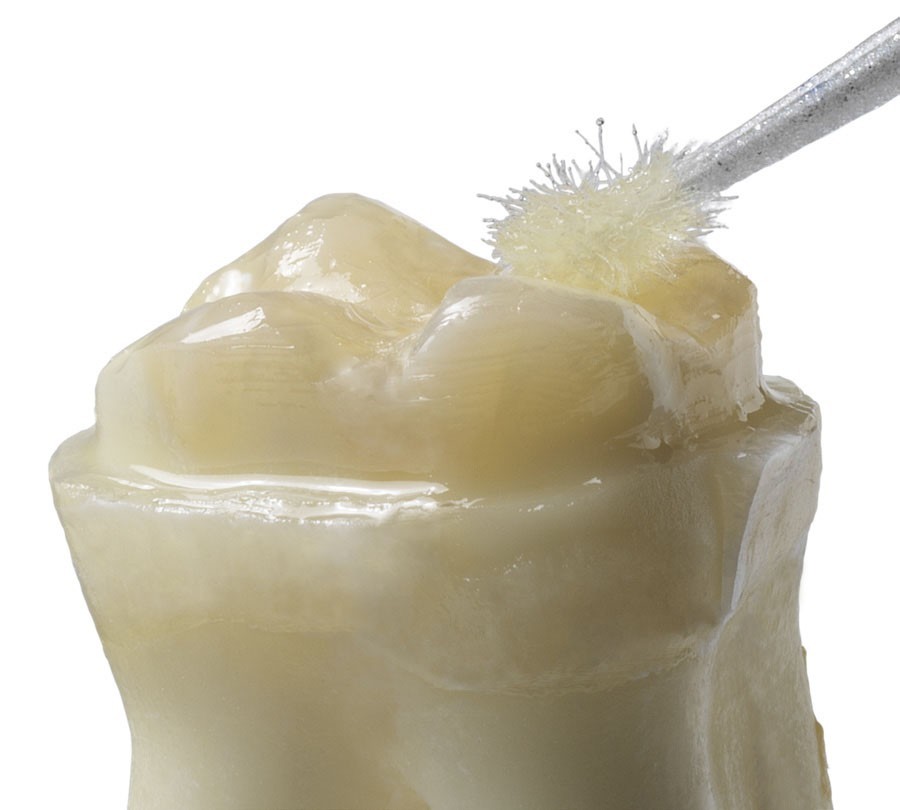 Dentsply Prime And bond NT Free Shipping