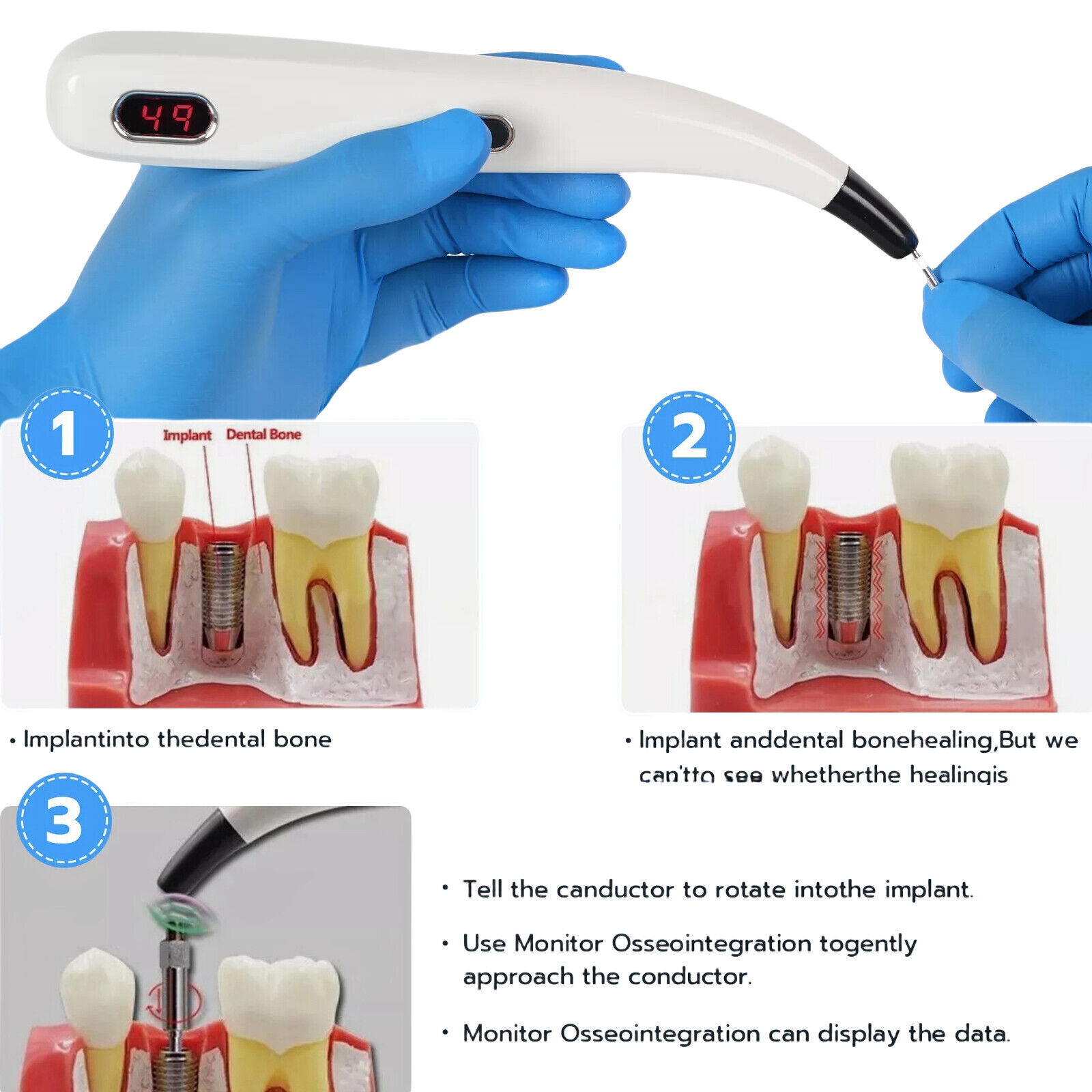 Dental Monitor Osseointegration RFA Inplant Stability Test Unit ISQ USA