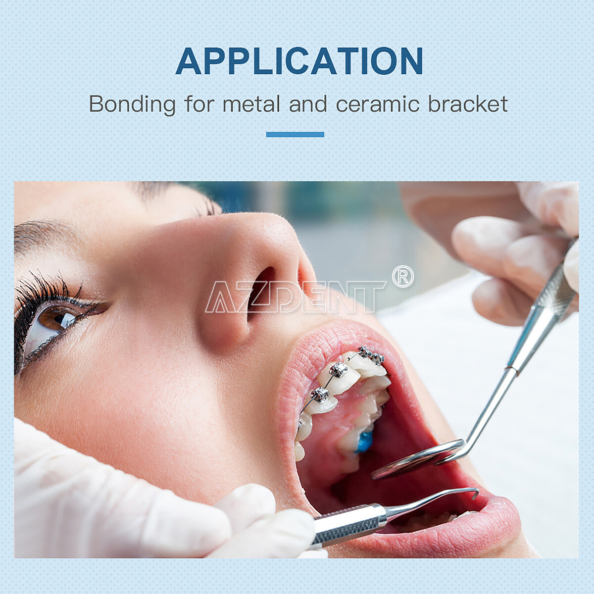 Dental Orthodontic Light Cure Composite Syringe Kit Bonding System Adhesive Set