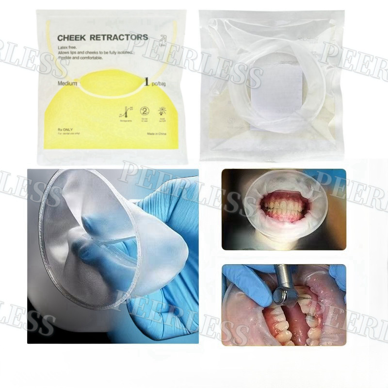 Dental Mouth Opener Lip Cheek Retractors O Shape Intraoral Lip Expander Opener M