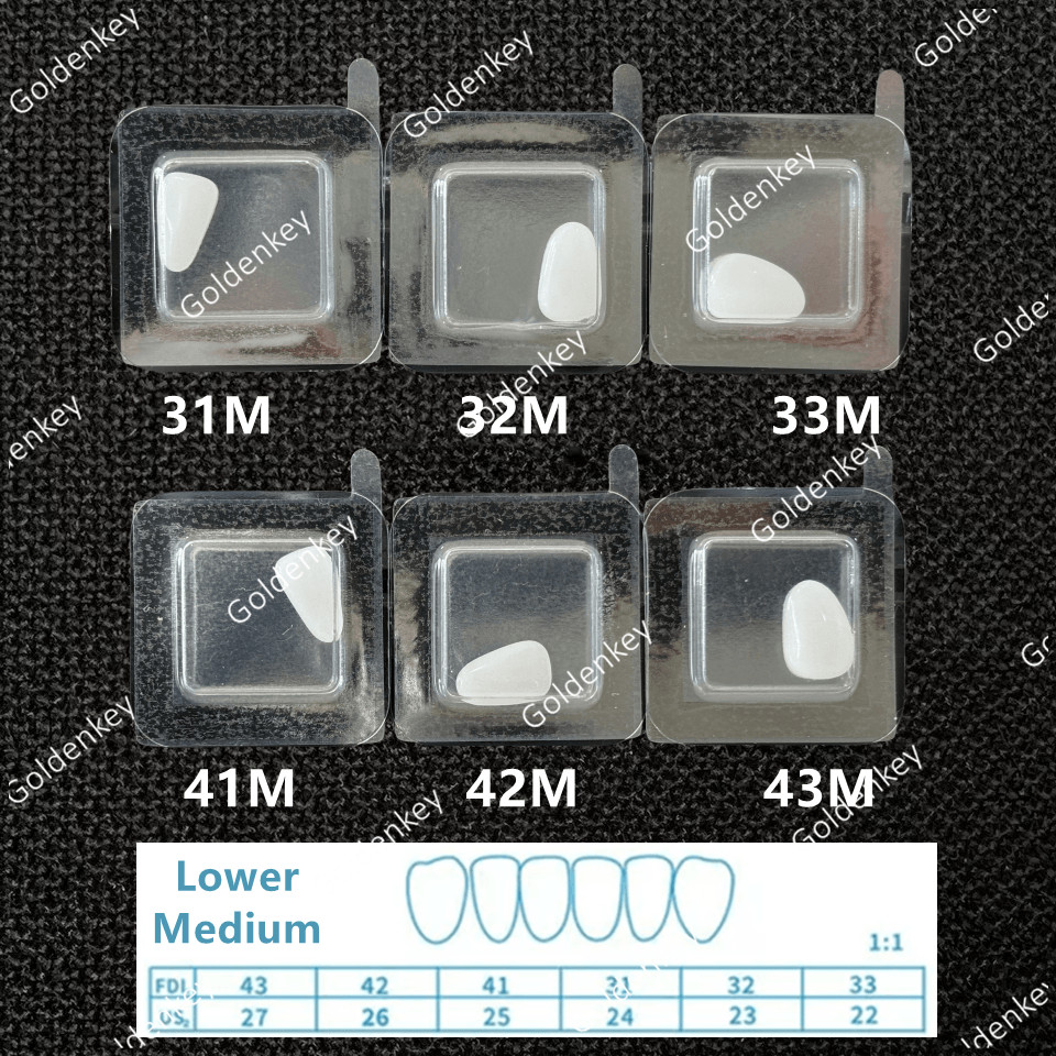 Dental Composite Porcelain Veneers Resin Light Cure Anterior Teeth Whiten Veneer