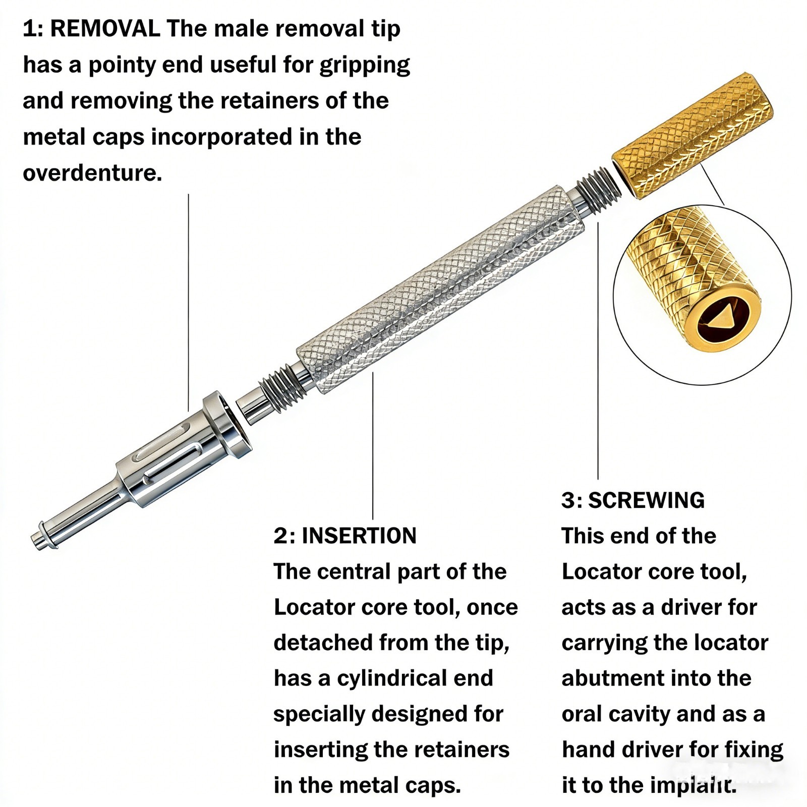 Zest Classic LOCATOR Core Tool for Legacy Locator Retention Cap Abutment Driver