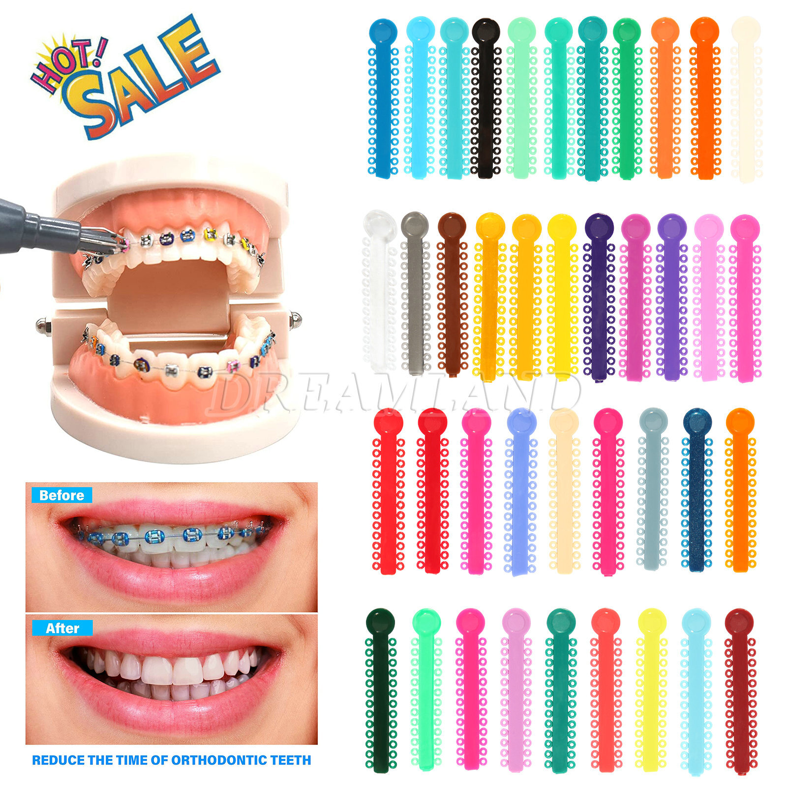 1040pcs Dental Orthodontic Ligature Ties Braces Elastic Rubber Bands 43 Colors