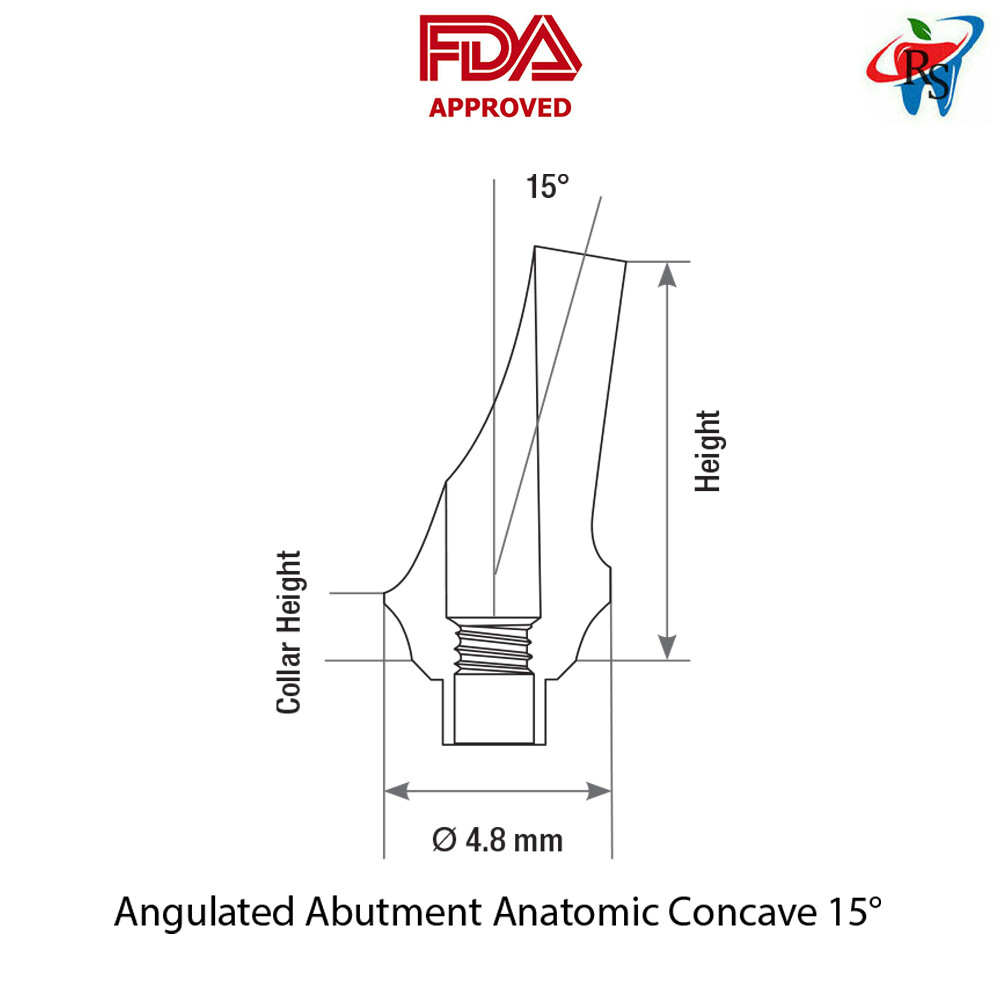 5pcs DSI Abutments Concave Anatomic Angulated 15° Titanium Int Hex 1-4mm