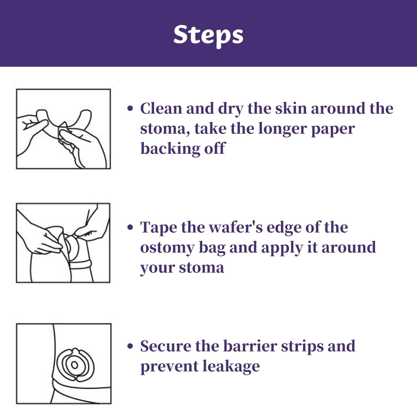 XIMYWRD Ostomy Barrier Strips, Elastic Skin Strips Non-woven Fabric