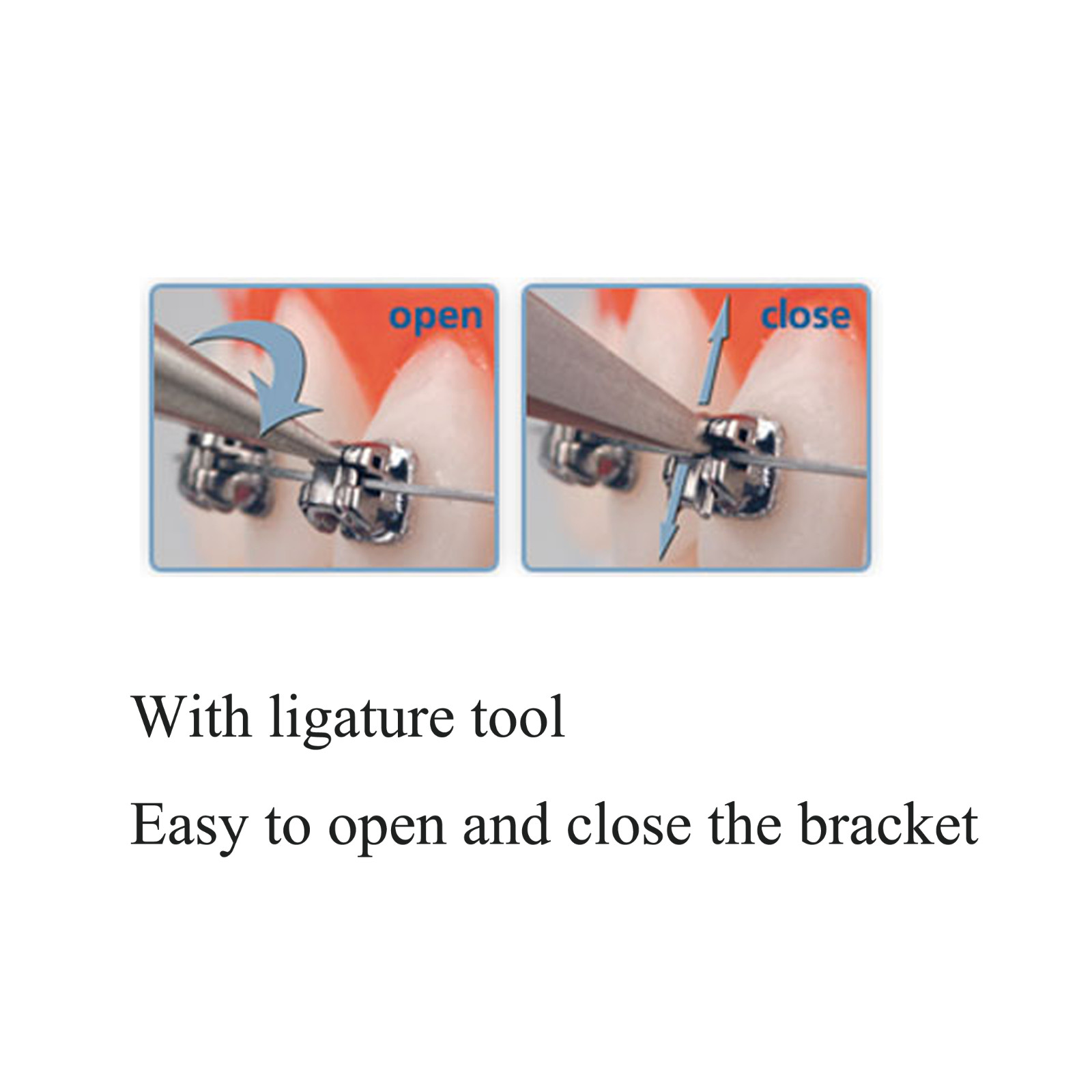 Orthodontic Self Ligating Brackets Mini Metal Braces Roth MBT 022 345H DAMON Q