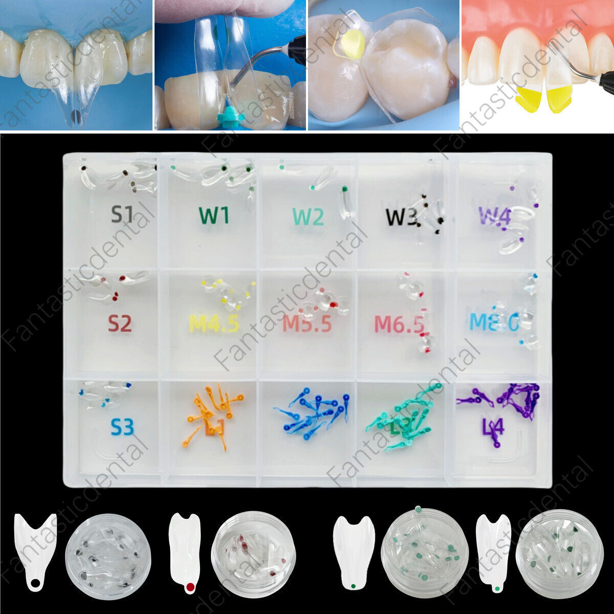 Dental Transparent Matrix Clear Bow Matrice Band Anterior Front Bioclear TorVM