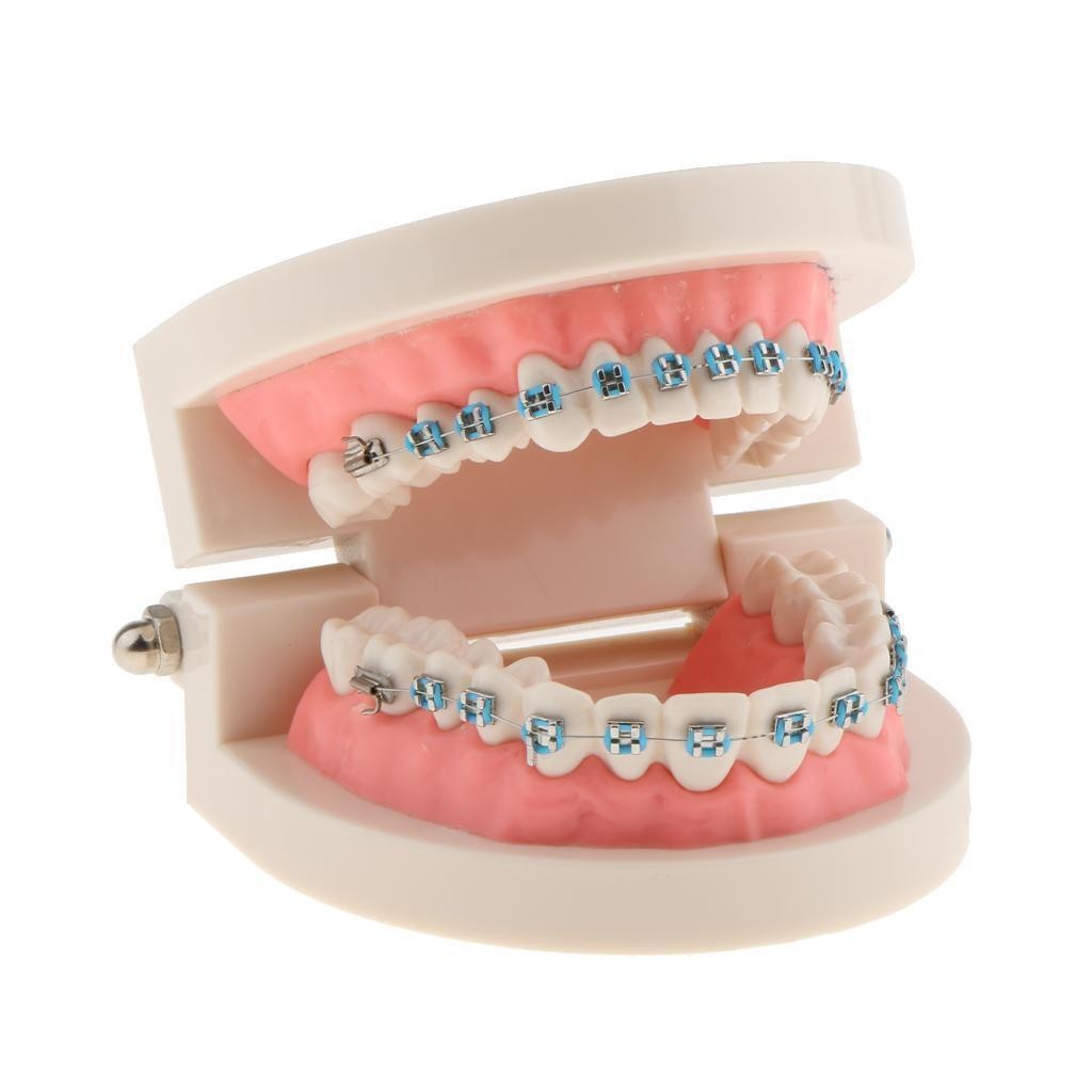 Dental Metal Model Orthodontic Adult Standard Teeth Hoop Brackets Ligature Tie