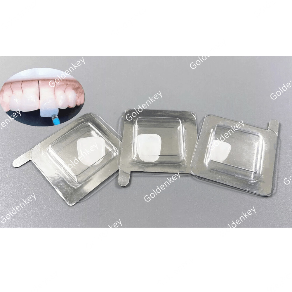 Dental Composite Porcelain Veneers Resin Light Cure Anterior Teeth Whiten Veneer