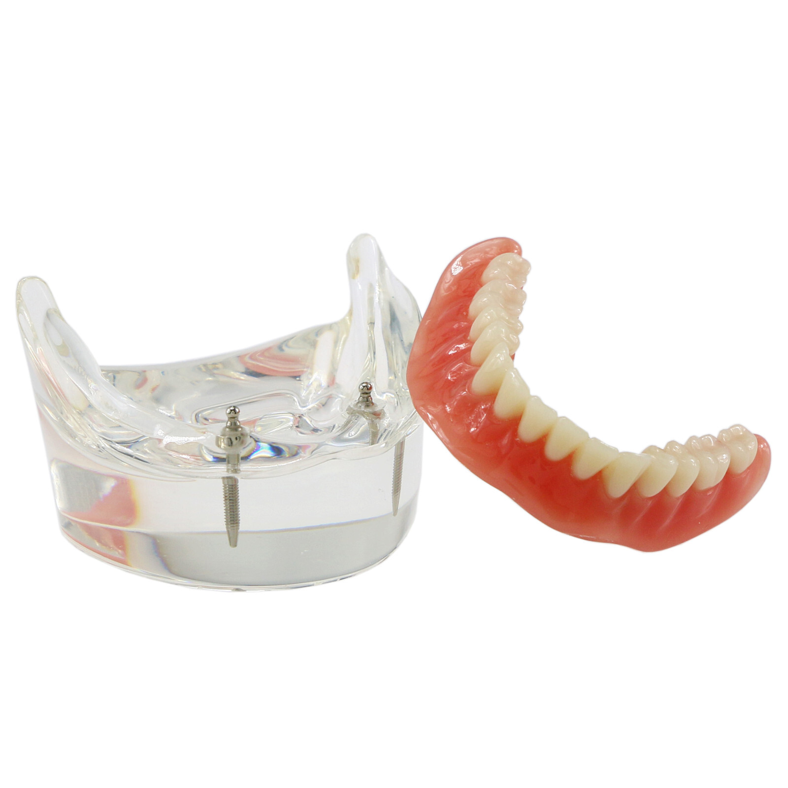 Implant Typodont Teeth Restoration Model Overdenture Practice Demo Series Dental