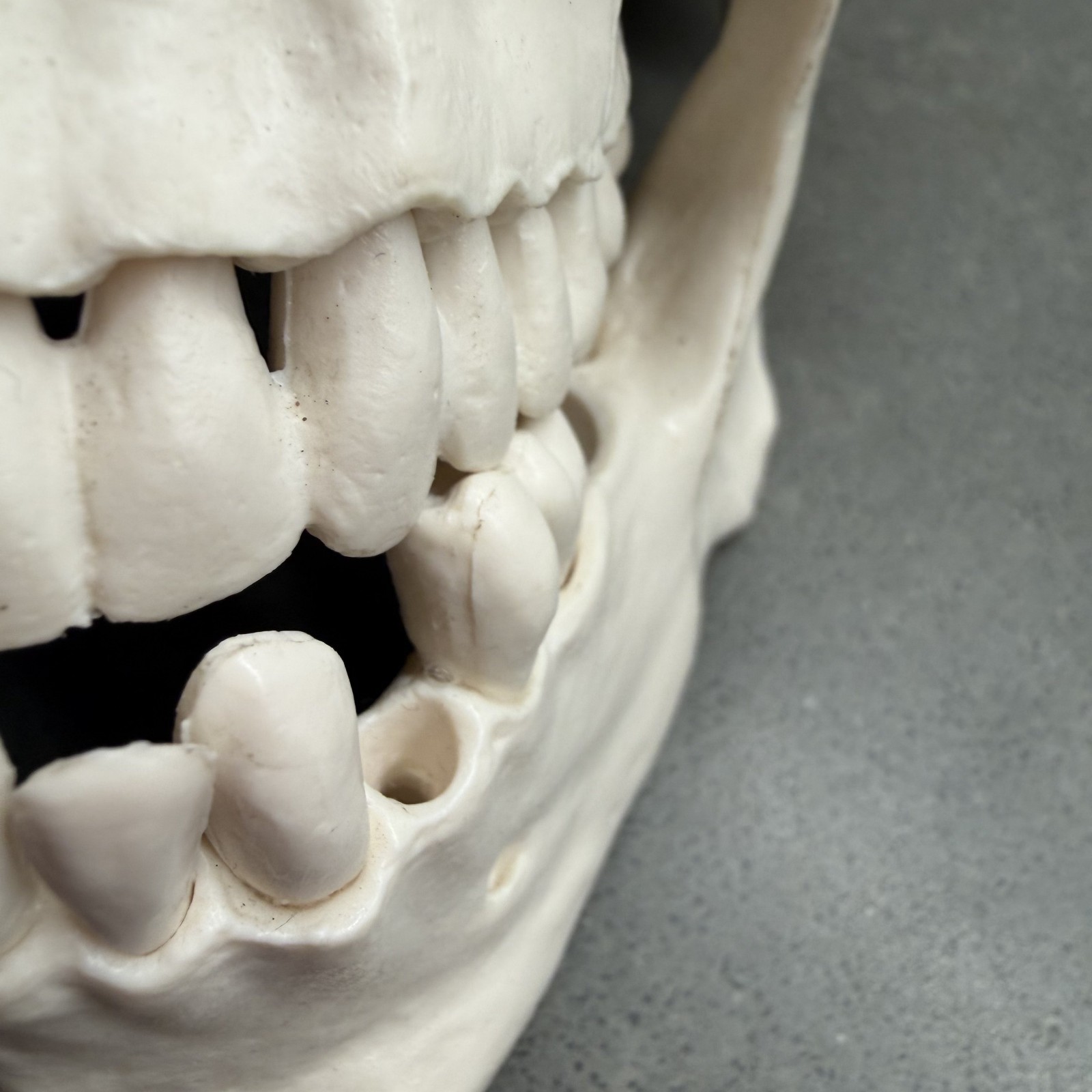 Skull~Medical Dental Anatomical Model~1 To 1~Removable Lower Jaw And Cranium