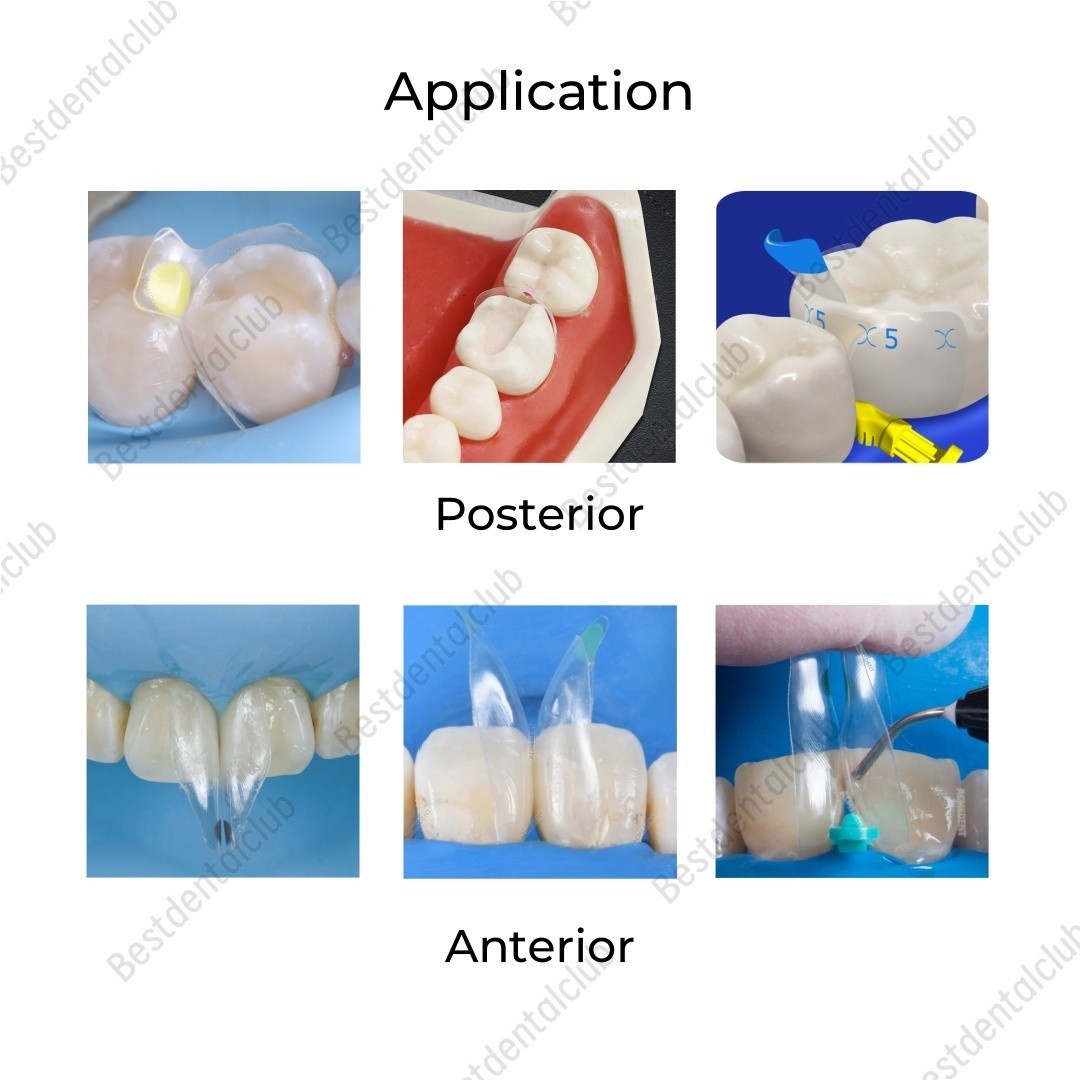 Dental Clear Matrix Anterior Posterior Transparent BT Matrices Fit BioClear USA