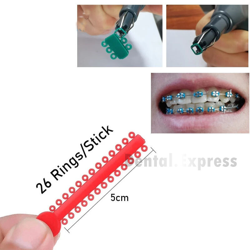 1040 Dental Orthodontic Elastic Ligature Ties Braces Elastomeric Ligating Module