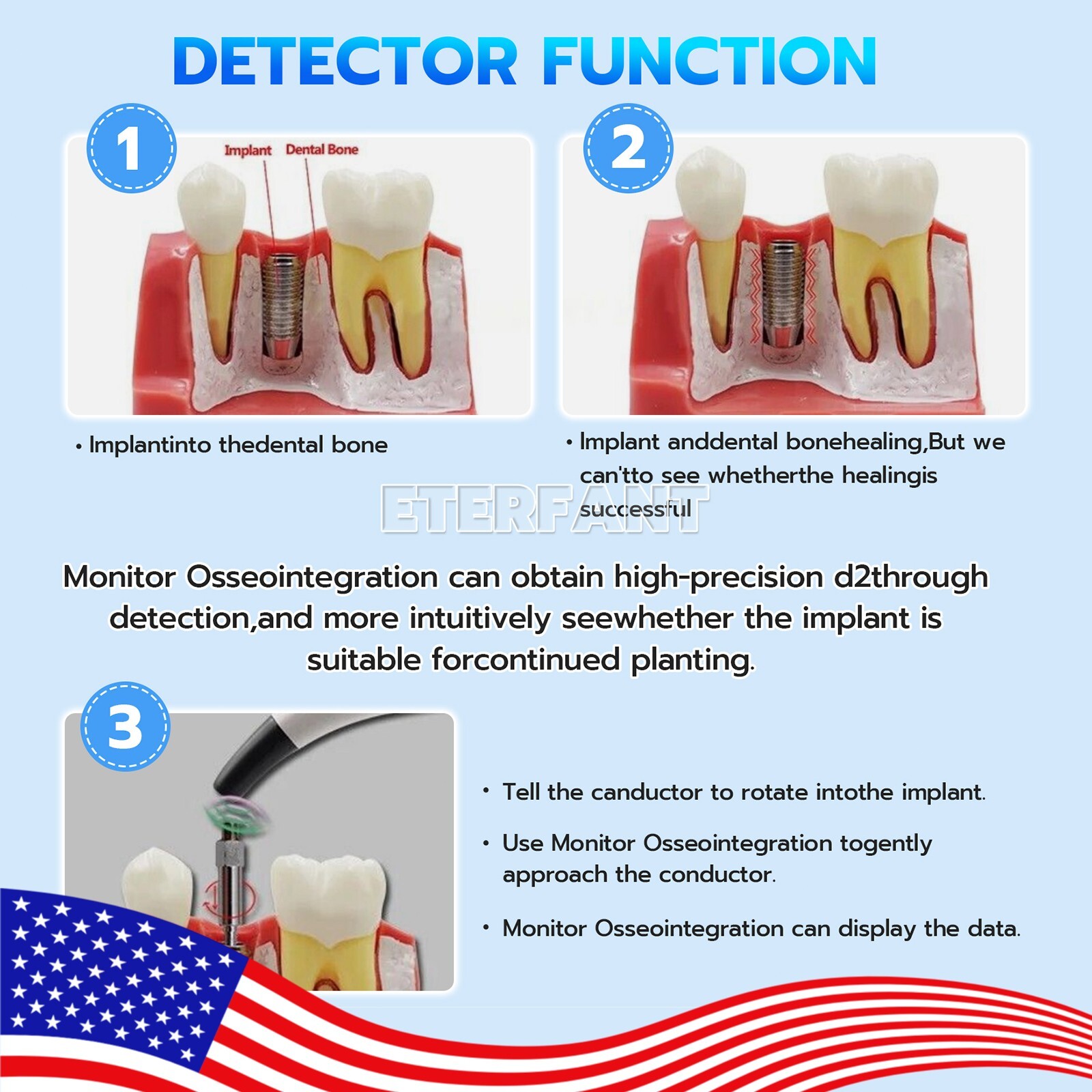 ETERFANT Monitor Osseointegration RFA Inplant Stability Test Unit Cordless USA