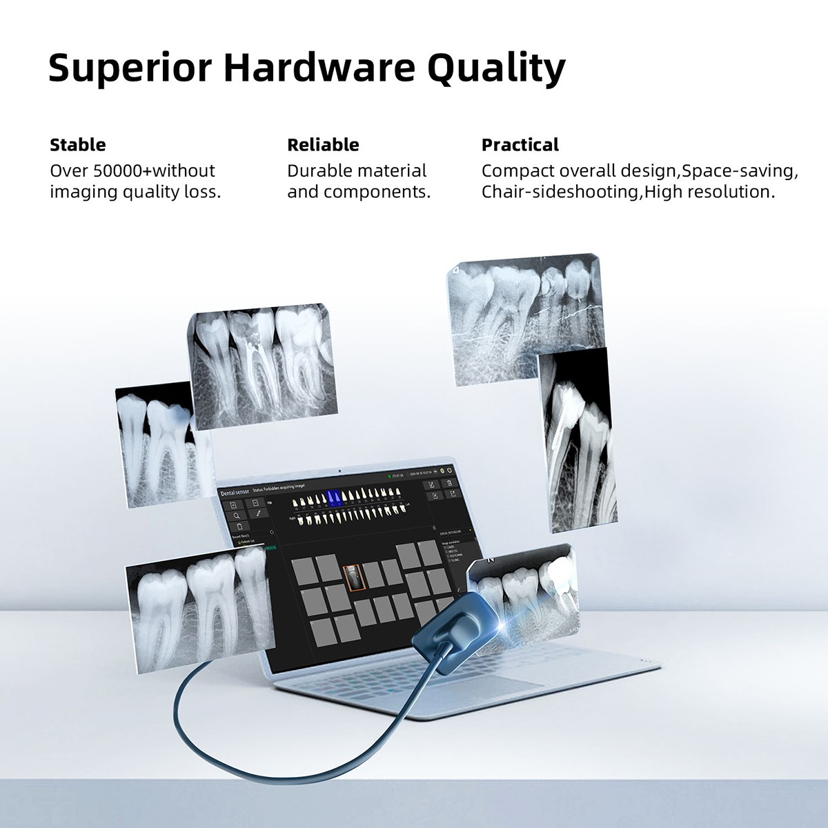 Dental Sectional Contoured Metal Band Metal Matrices Matrix Ring Resin Refill F1