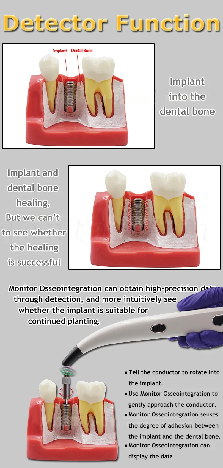 DENTAL NEW OSSTELL BEACON ISQ IMPLANT STABILITY METER TOOL INSTRUMENT