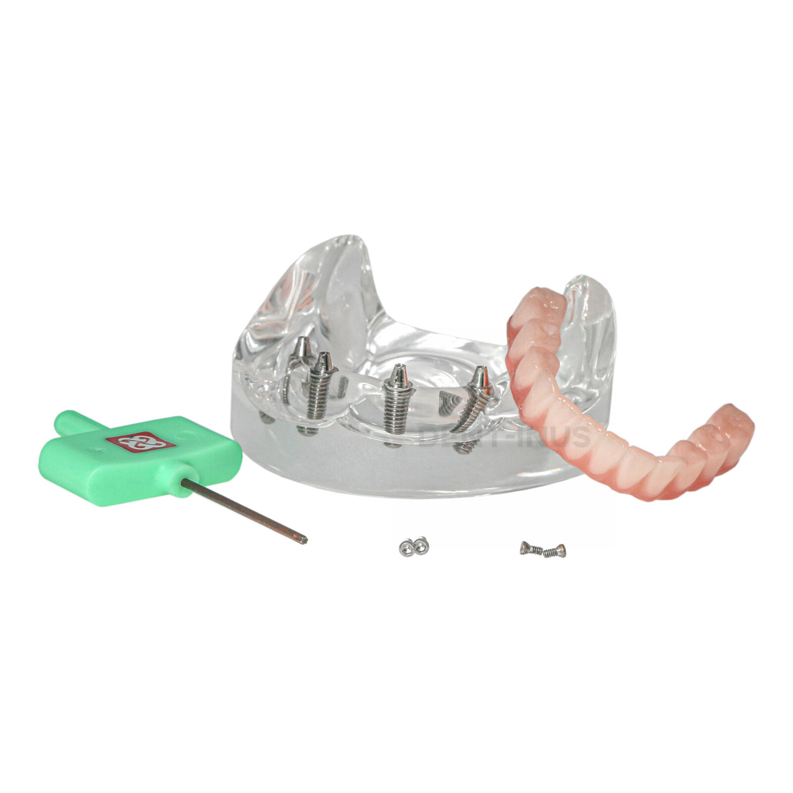 Dental 4 Implants Demo Implant Teeth Model Restoration Overdenture Upper/Lower