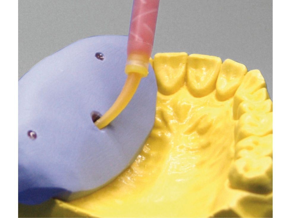 Vincismile Automix Flexible A-Silicone-Based for Gingival Masks Curing Silicone