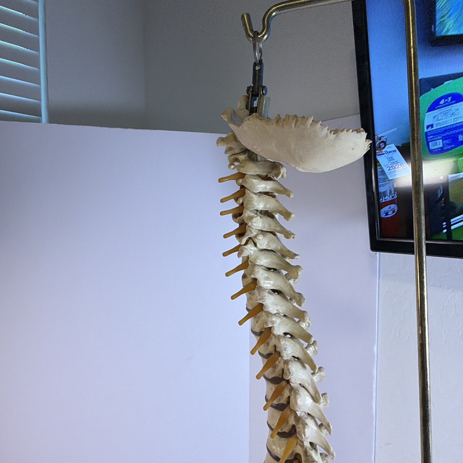 Vintage ORTHOFLEX Human Pelvis Vertebrae Skull Base Spinal Nerve Cord Spine