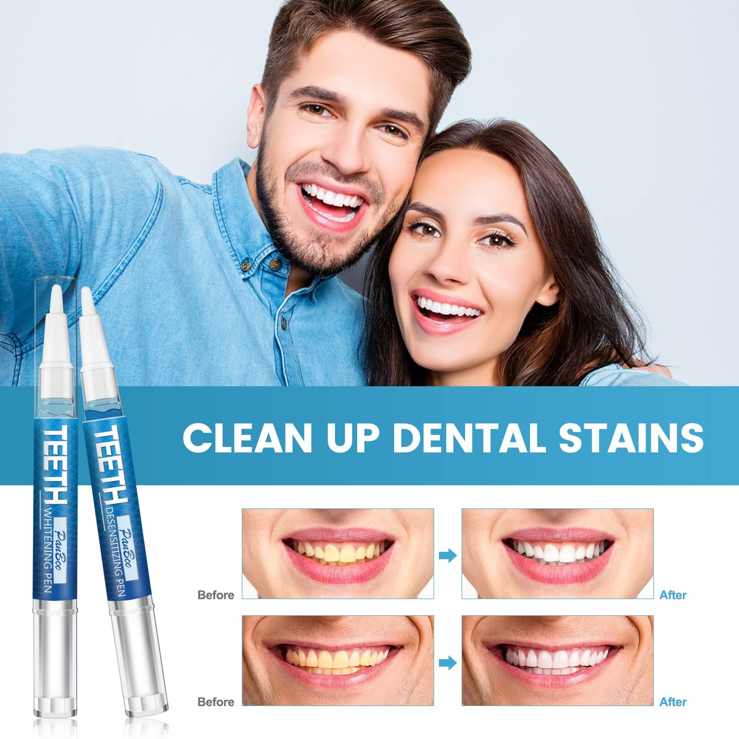 Teeth Whitening Pen 4+1(5 Pack), 70+ Treatments, 0.24 Fl Oz (Pack of 5), Bule