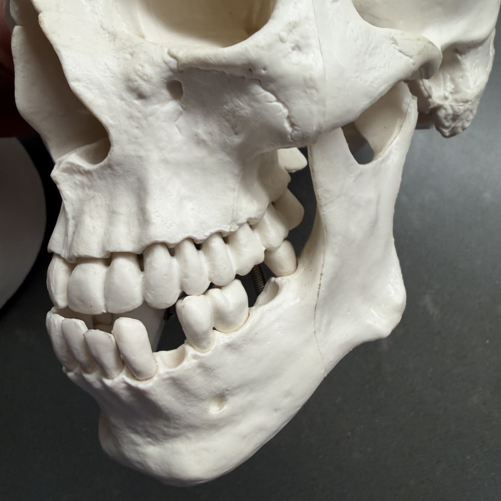 Skull~Medical Dental Anatomical Model~1 To 1~Removable Lower Jaw And Cranium