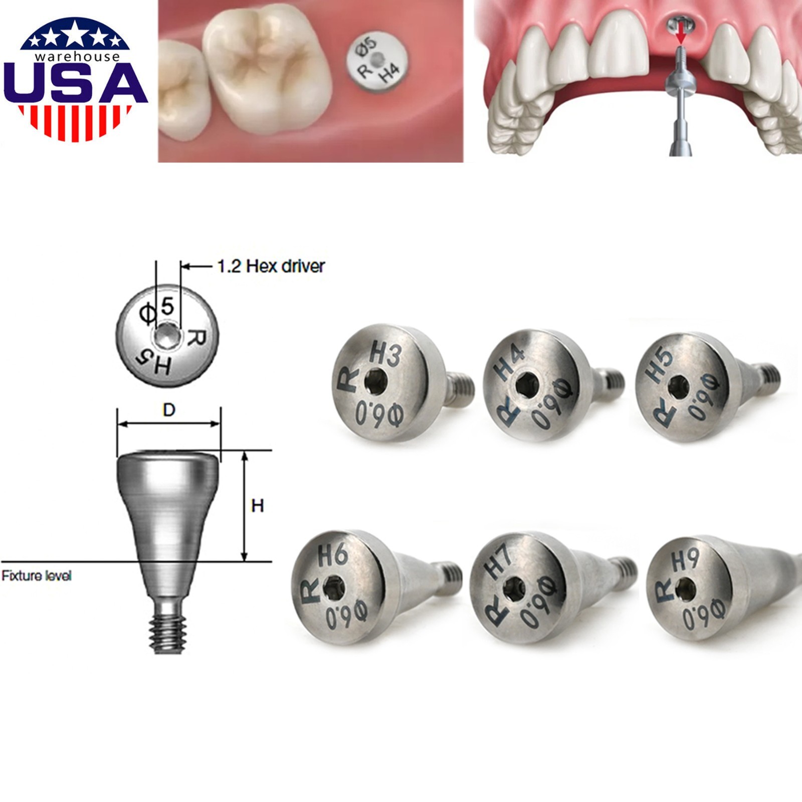 US 5Pcs Dental Healing Abutment Mini/Regular Hiossen Osstem ET TS Ti Implant Cap