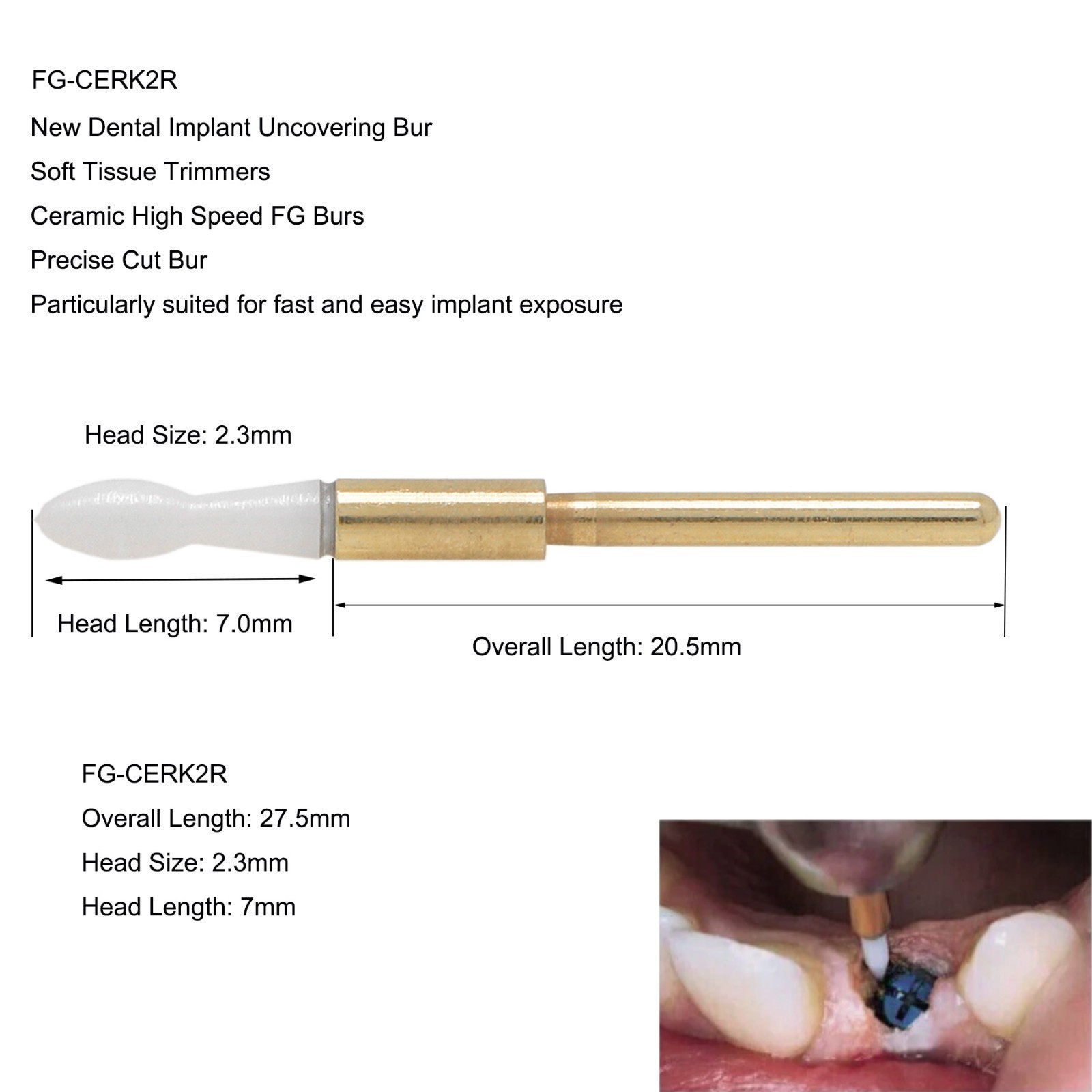 3PCS Dental Surgical Ceramic Soft Tissue Trimmer Bur for Gingivectomy – FG 2.3mm