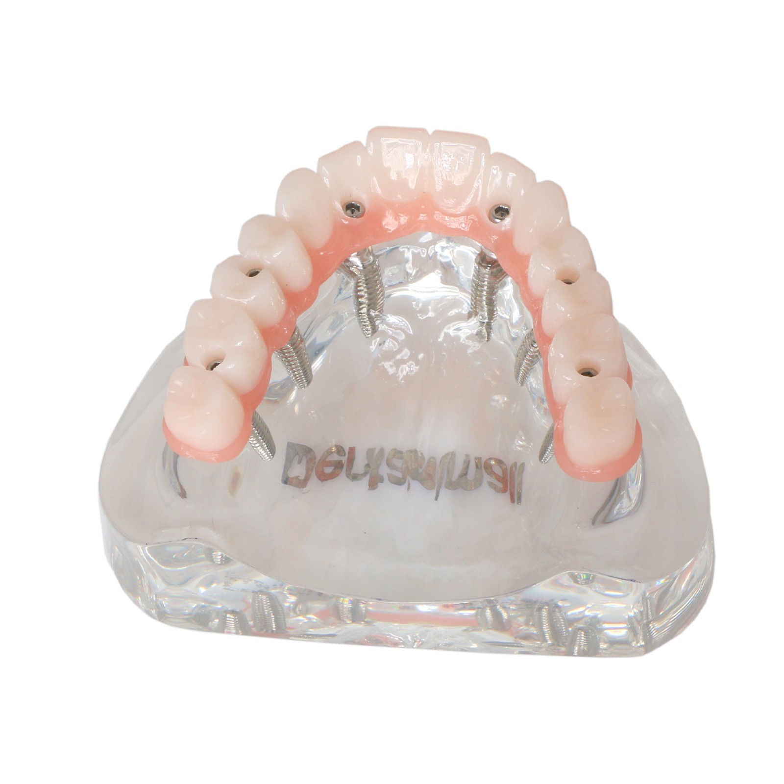 Dental Implant Overdenture Model Upper Lower Jaw Teeth Model with 2/4/6 Screws