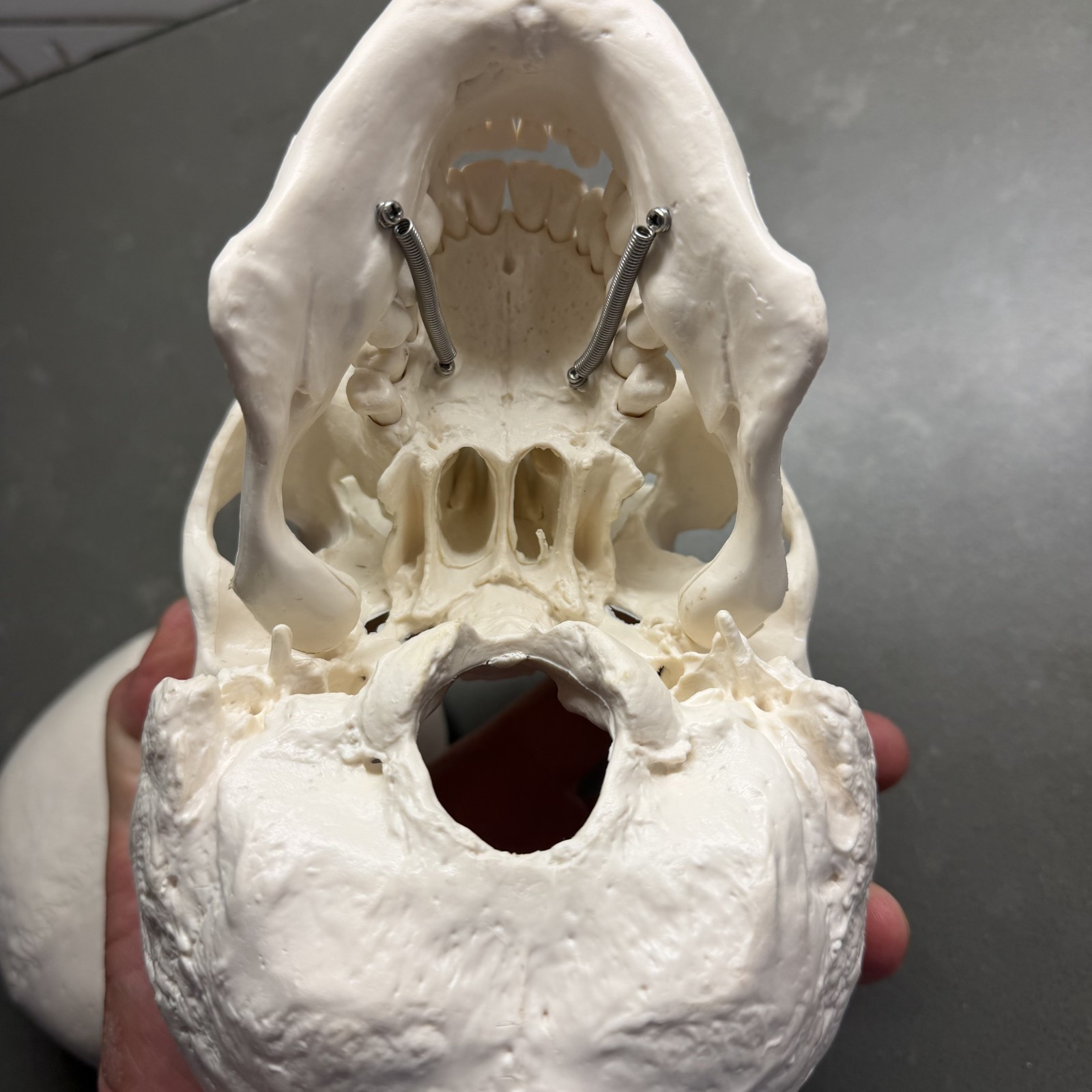 Skull~Medical Dental Anatomical Model~1 To 1~Removable Lower Jaw And Cranium
