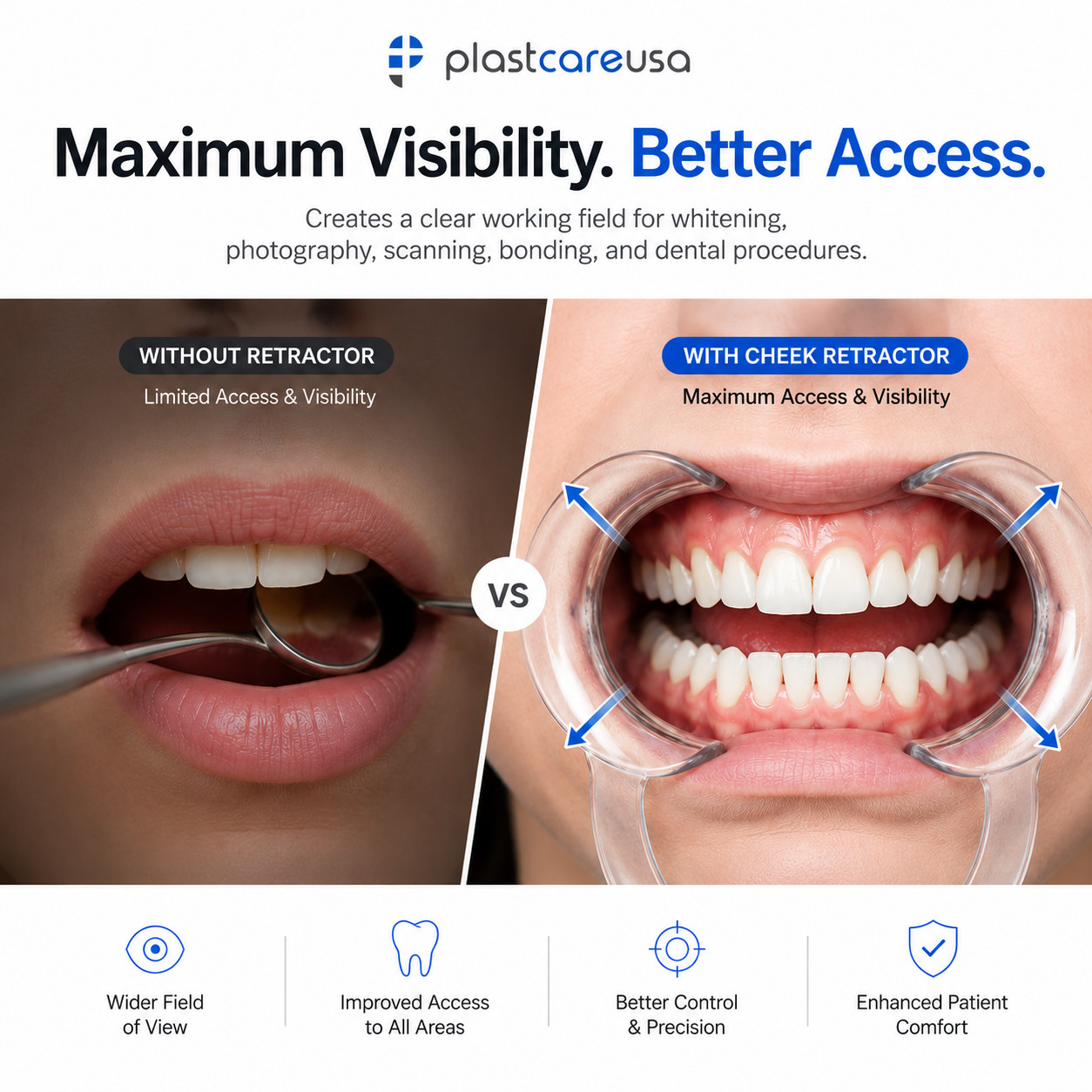 20 x SMALL Kids Teeth Whitening Cheek Retractor, Dental Mouth Opener Game Watch